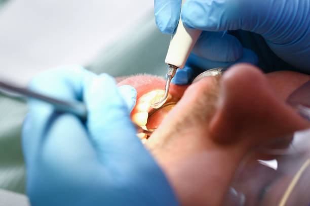 Best Emergency Treatment for Toothache in Medina, NY