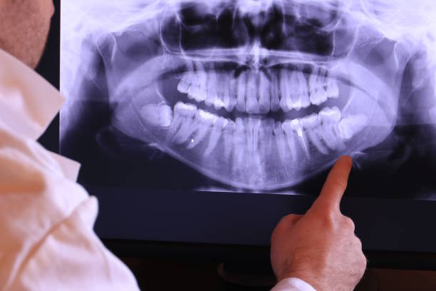 Best Walk-In Emergency Dentist in Medina, NY